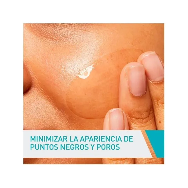 ژل ضد جوش سراوی مدل imperfections حجم 40 میلی لیتر 102255773